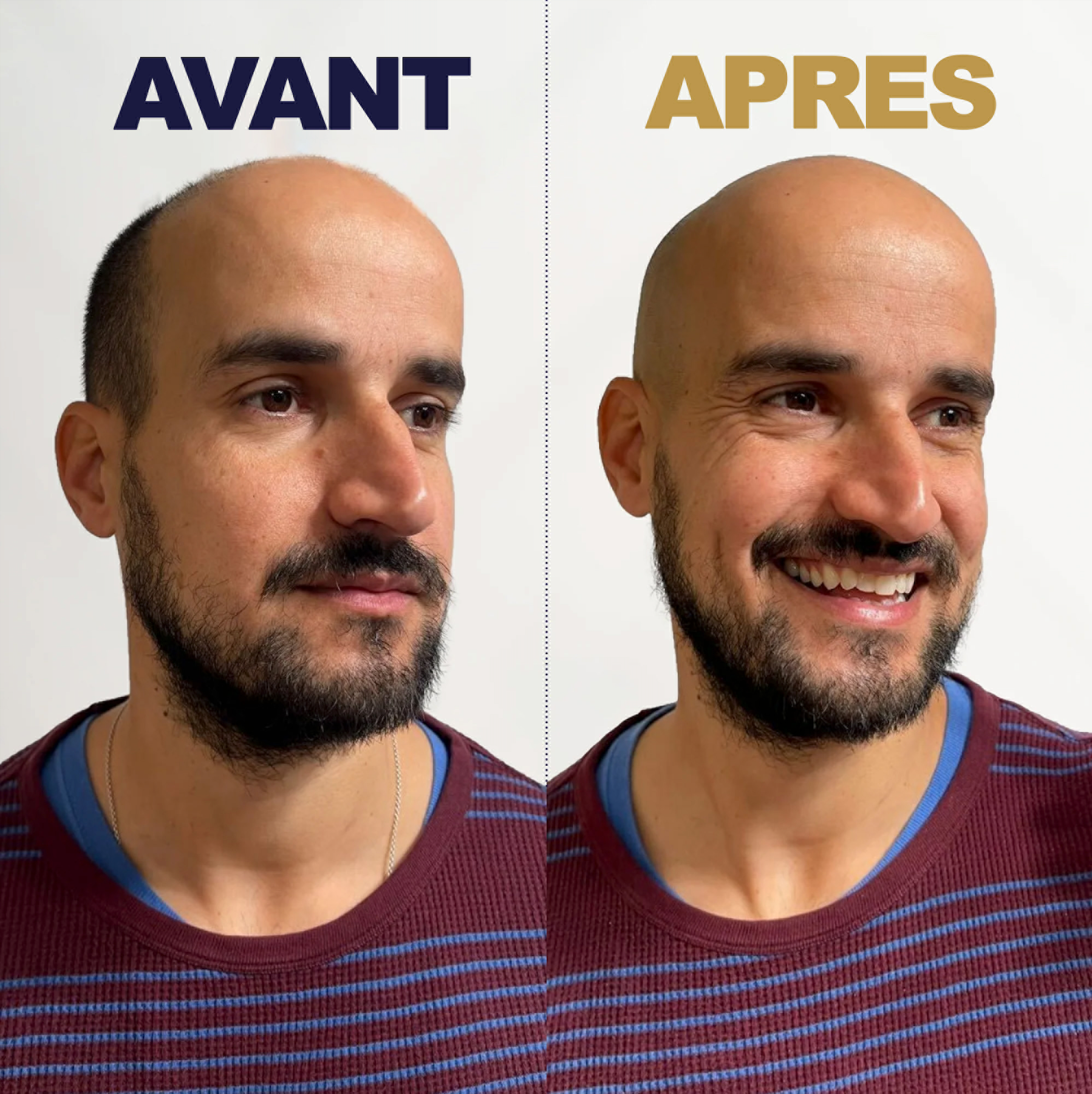 Rasoir électrique Bravnix® - Série PRO